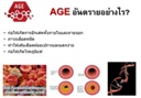 AGE
