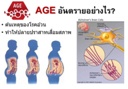 AGE