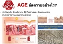 AGE